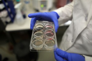 Tray of stem cells. (Photo provided by Getty Images)
