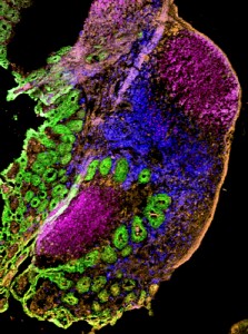Visualizing bacterial infection in the intestine. Soon after eating Listeria (red) the bacteria can be seen in the Peyer's patches of the intestine. (magenta=B cells); green=intestinal villi; blue=innate immune cells.) (Photo provided by Daqi Xu)