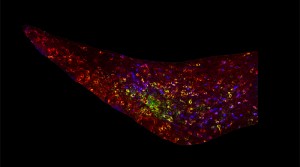 A segment of the mouse brain glows with fluorescent markers that show dopamine neurons. The green cells provide dopamine to the subventricular zone, a region that produces new neurons throughout adulthood to regulate the sense of smell.