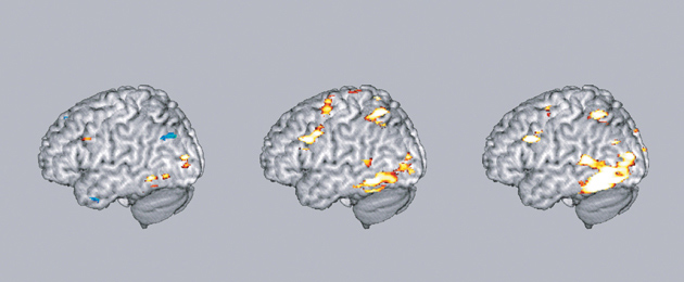 Image of brain renderings, highlighting various parts of the brain.