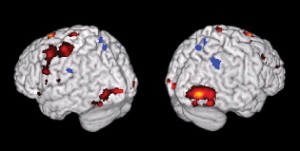 Image of brain renderings highlighting various parts of the brain.