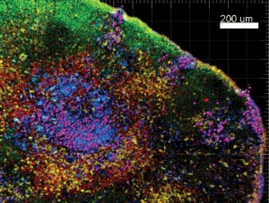 Purple dots represent bacteria in listeria infection, one of the pathogens UConn Health Center immunology researchers are continuing to study with the backing of a $13 million federal grant.