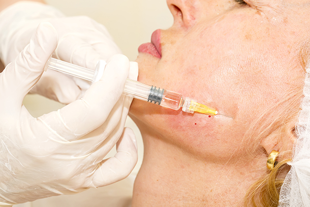 A UConn dental radiologist says the use of Botox to relieve jaw pain may cause bone density loss. (Shutterstock image)