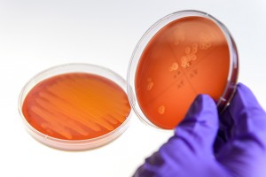 Plates showing MRSA resistant bacteria, right, and a normal culture, seen at the Anderson lab on Jan. 23, 2015. (Peter Morenus/UConn Photo)