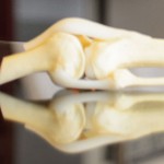 A joint bone in Dr. Cato Laurencin's office at UConn Health in Farmington. (Peter Morenus/UConn Photo)