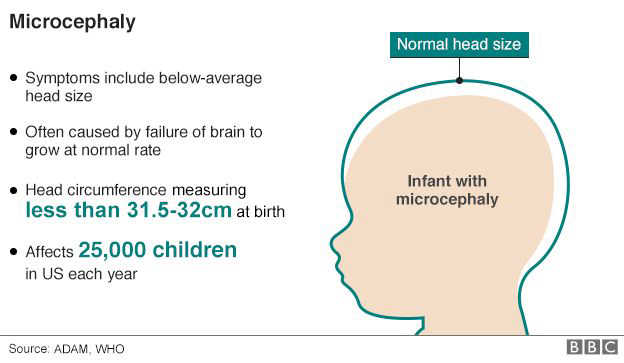 The Zika virus, which is transmitted by <em>Aedes</em> mosquitos, has been linked with a rising number of cases of babies in Brazil born with microcephaly. (From the BBC website. Source: ADAM, WHO)