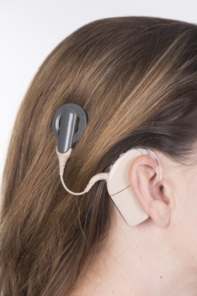 Young woman with cochlear implant close up. (iStock Photo)