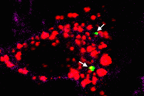 Lipopolysaccharides from bacteria (green) sneak into the endosome (red) of human macrophage cells by hiding in vesicles. From the endosome, they can move into the cytosol, setting off alarms that lead the cell to destroy itself. (Image courtesy of Vijay Rathinam)