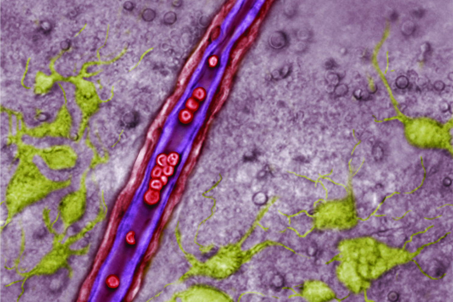 A blood vessel in the retrotrapezoid nucleus (RTN). Endothelial cells lining the vessel are purple, red blood cells are red, and neurons are green. Astrocytes are not identified in this image, but would be among the greyed background cells. (Dan Mulkey/UConn Image)