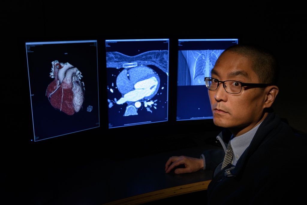 Dr. Clifford Yang looks over a 3-D printed model of a heart, and x rays at UConn Health. (Peter Morenus/UConn Photo)