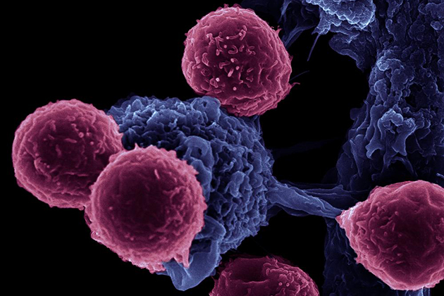 Immune cell communication, dendritic cells stimulated with adjuvant silicon microparticles interact with T cells. Taken using an FEI microscope, magnification 16,000x. (Rita Serda/FEI Image)