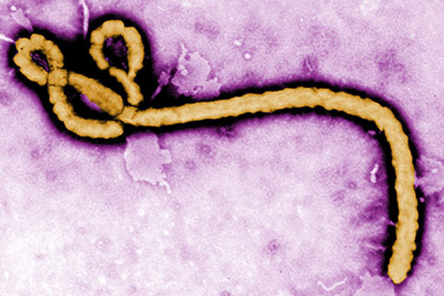 The Ebola virus. (Center for Disease Control photo)