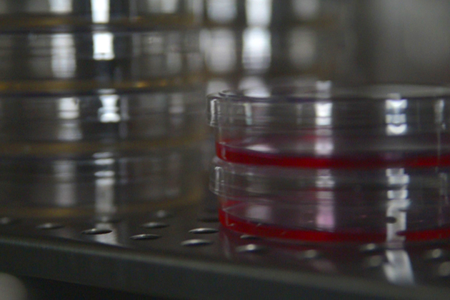 Petri dishes containing stem cells at a lab at UConn Health. (Elizabeth Caron/UConn Photo)