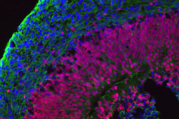 A brain bit grown in Stormy Chamberlain’s lab. The neural stem cells are red, neurons green, and the nuclei blue. (Noelle Germain/UConn Photo)