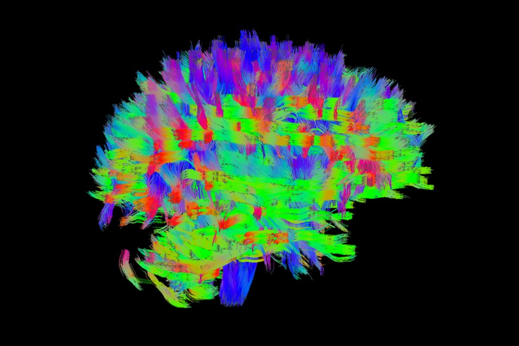 Map of brain activity