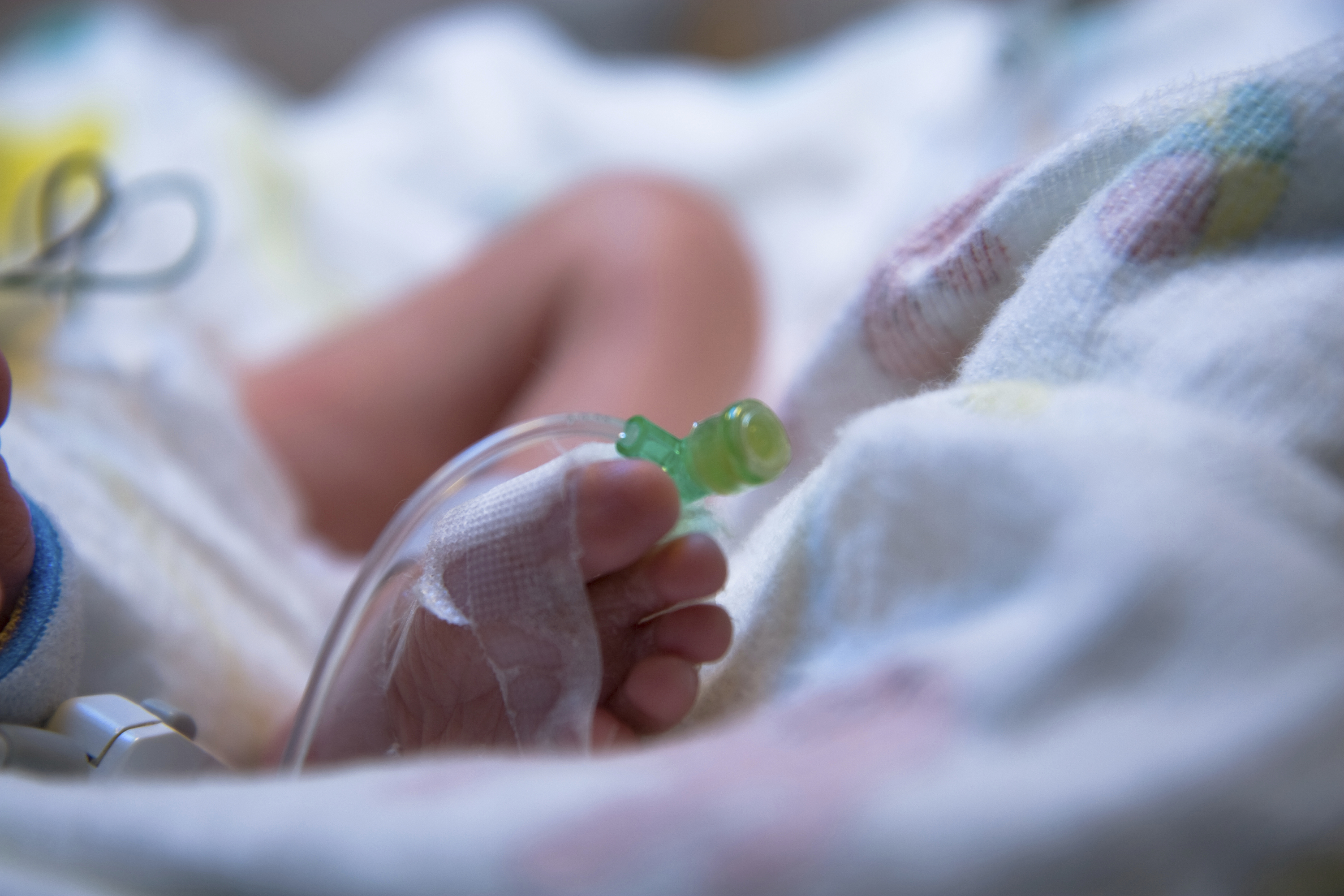 A premature baby undergoing medical procedures in the hospital (iStock Photo)