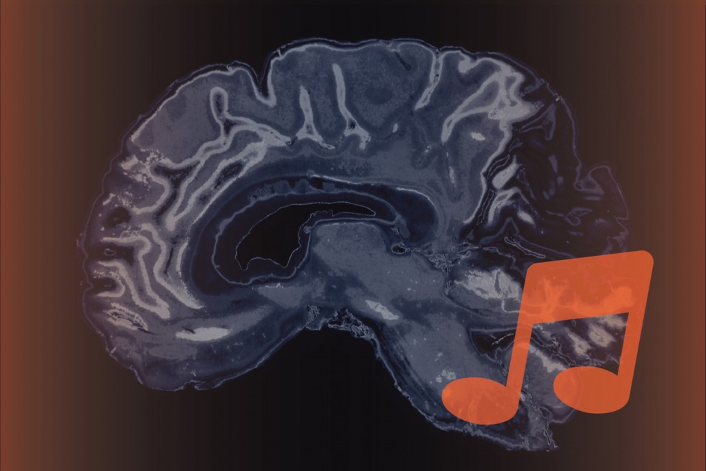 Music and the brain. (Christa Tubach/UConn Image)