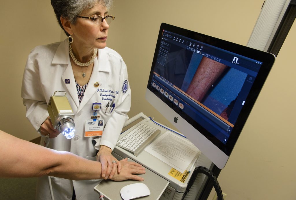 “This is a big clinical breakthrough in dermatology. Up to 60 percent of our patients with a suspicious skin lesion or mole are being spared a biopsy,” thanks to confocal technology says Dr. Jane Grant-Kels of UConn Health Dermatology (Janine Gelineau/UConn Health Photo)