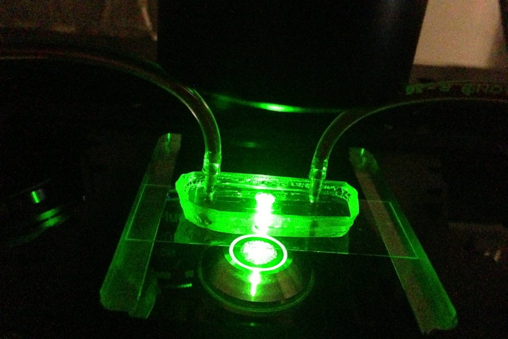 Researchers in engineering professor Anson Ma’s Complex Fluids Lab used a fluorescence microscope to illuminate a microfluidic device that simulates a blood vessel. The research team was then able to observe and measure how particles of different sizes behave in the bloodstream. (Anson Ma/UConn Photo)