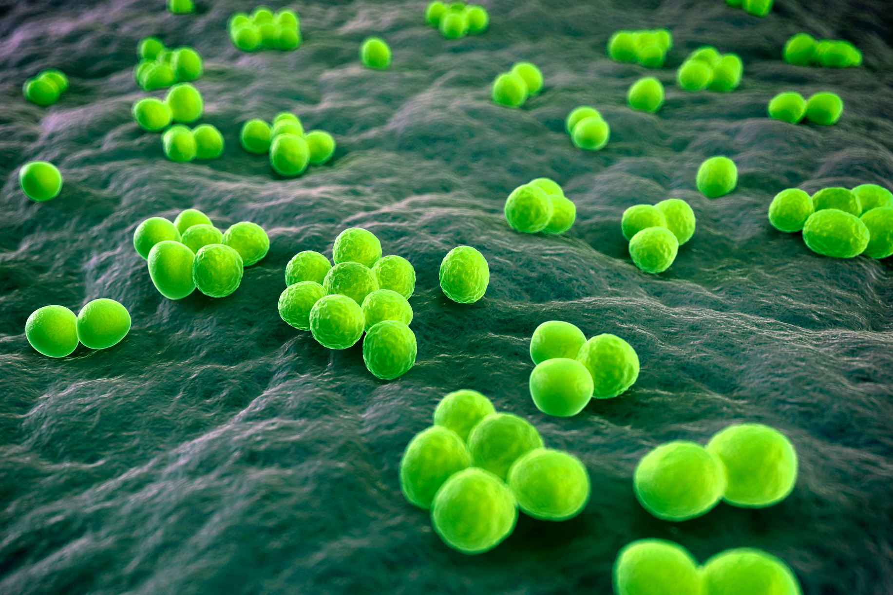 MRSA (methicillin-resistant Staphylococcus aureus) bacteria. (SCIEPRO/Getty Images)