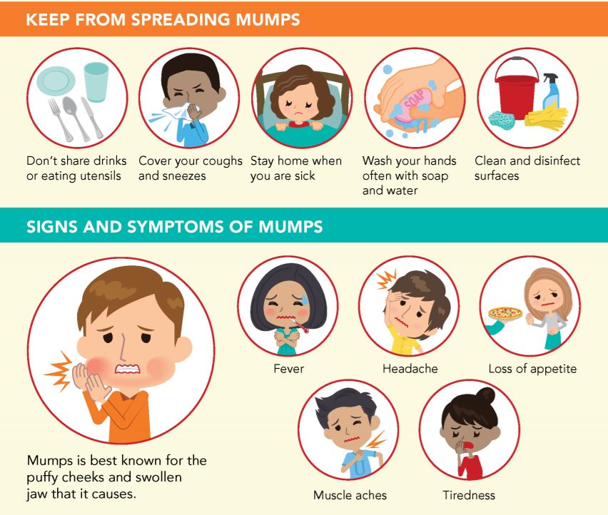 UConn/CDC infographic shares tips for preventing mumps and recognizing its common symptoms.