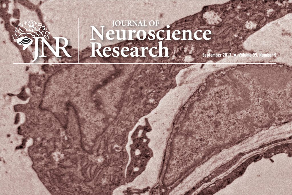 UConn Health's study will be Journal of Neuroscience Research cover story.