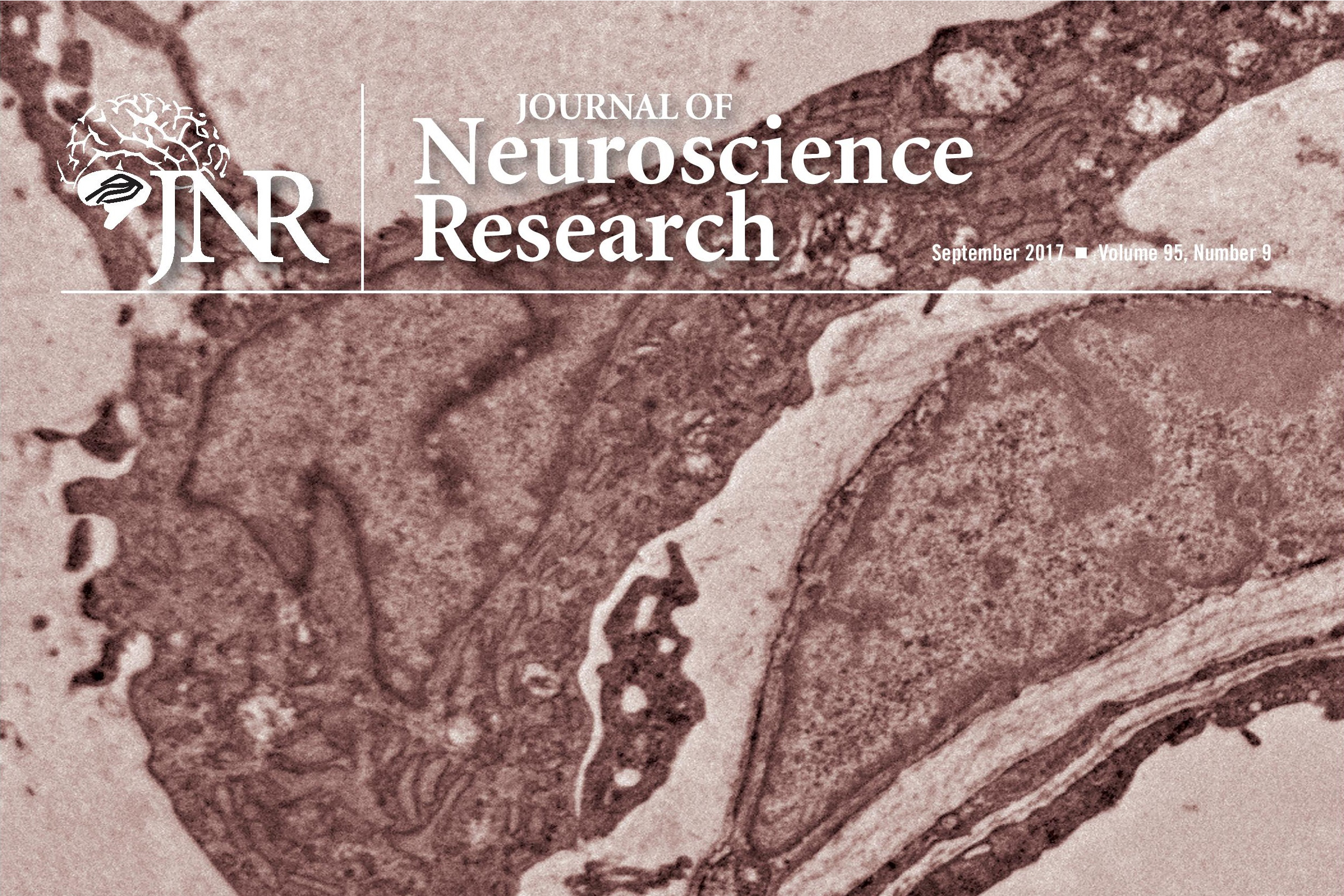 UConn Health's study will be Journal of Neuroscience Research cover story.