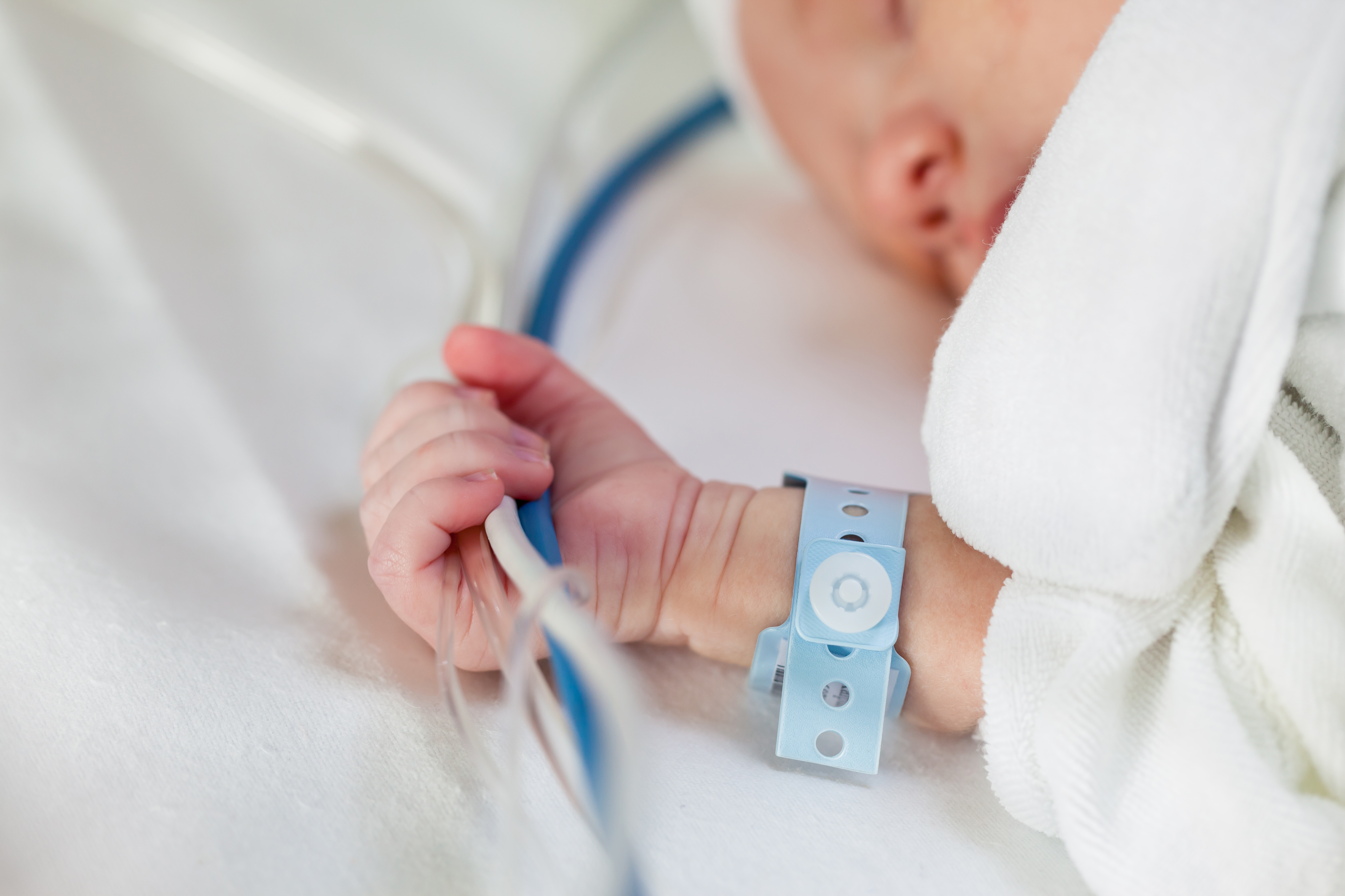 Close-up of a newborn baby holding life-support hoses and cables tight in his hand. (Getty Images)