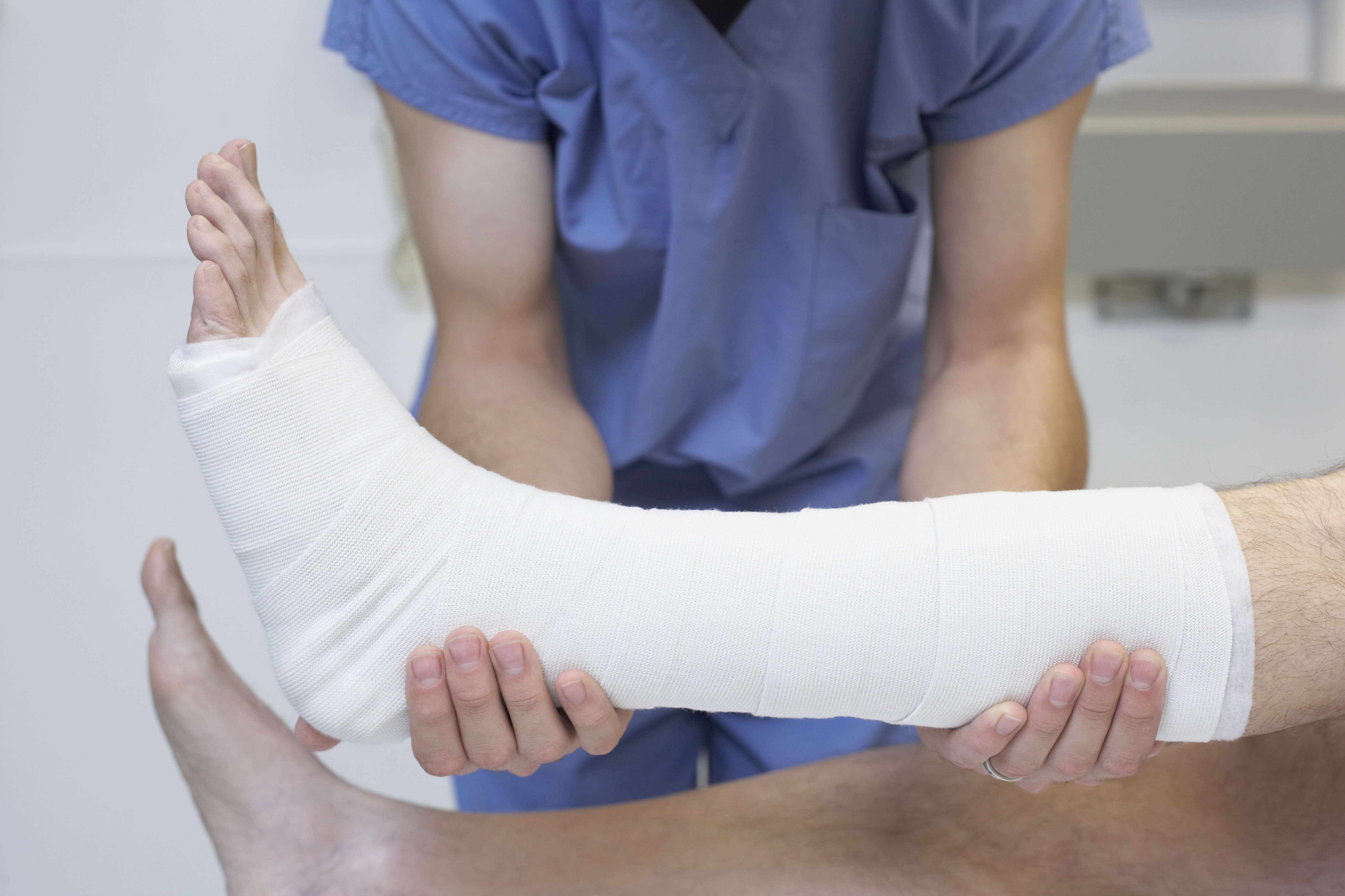 Image of a leg in a cast