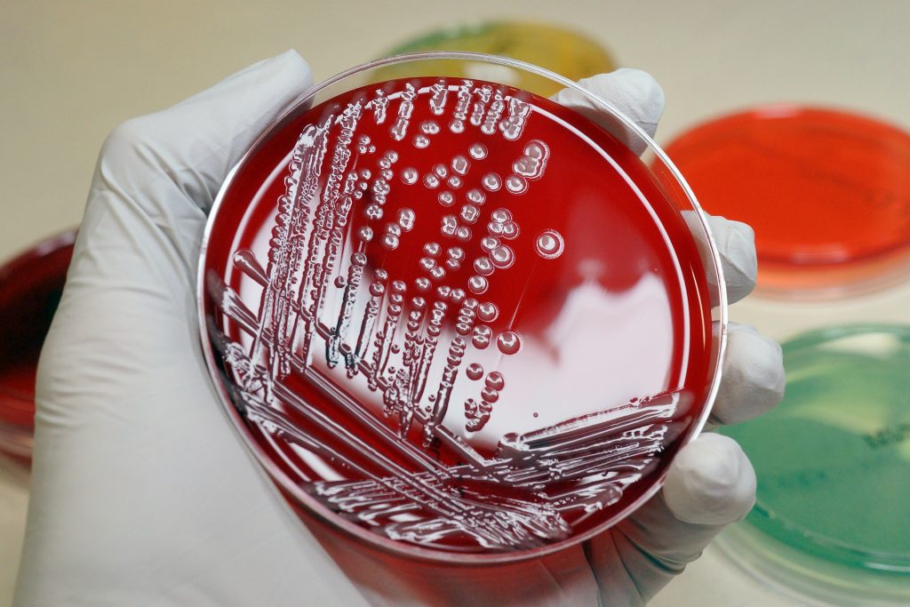 Colonies of a multi-resistant coliform bacteria (Escherichia coli). (Getty Image)