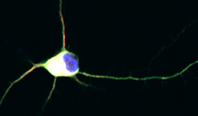 An image of immature retinal ganglion cell neuron from Dr. Trakhtenberg's research, adapted for a cover page of the International Review of Neurobiology volume on Axon Growth and Regeneration (Goldberg & Trakhtenberg, Eds, 2012, Vol 106: Academic Press)