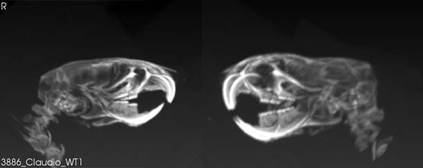 CT-scan images taken in Rahul Kanadia's lab of the mice with microcephaly (right) and without the condition (left). (Photo courtesy of the Kanadia Lab)