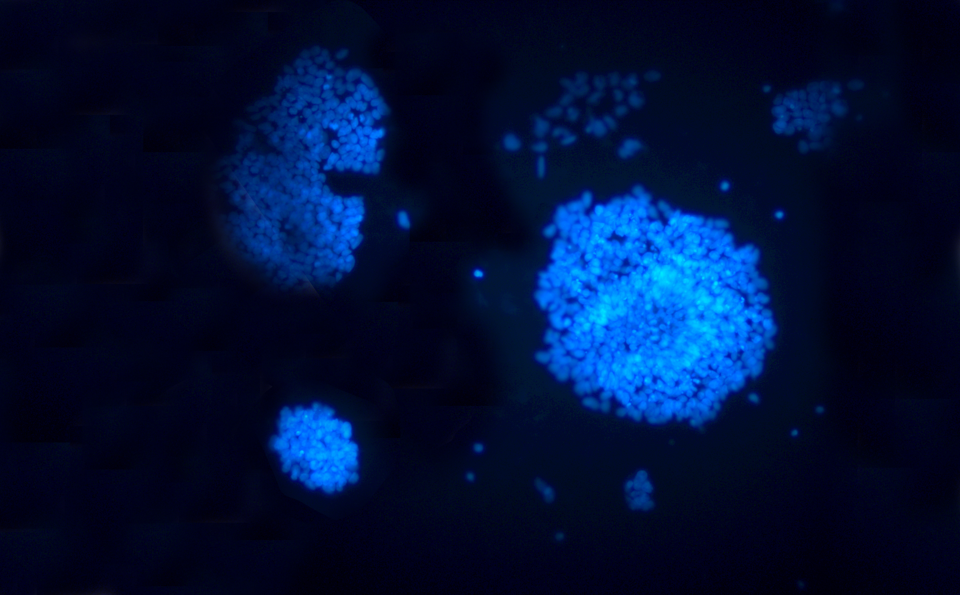 Human embryonic stem cells grown in UConn's Stem Cell Core Laboratory. (UConn Photo)