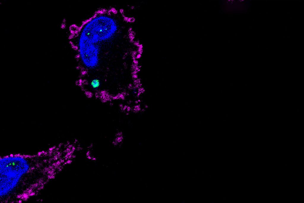 The DNA receptor (green) is bound to DNA (blue) inside immune cells (macrophages) (cell membrane colored pink) during infection. (Image courtesy of the Rathinam Lab)