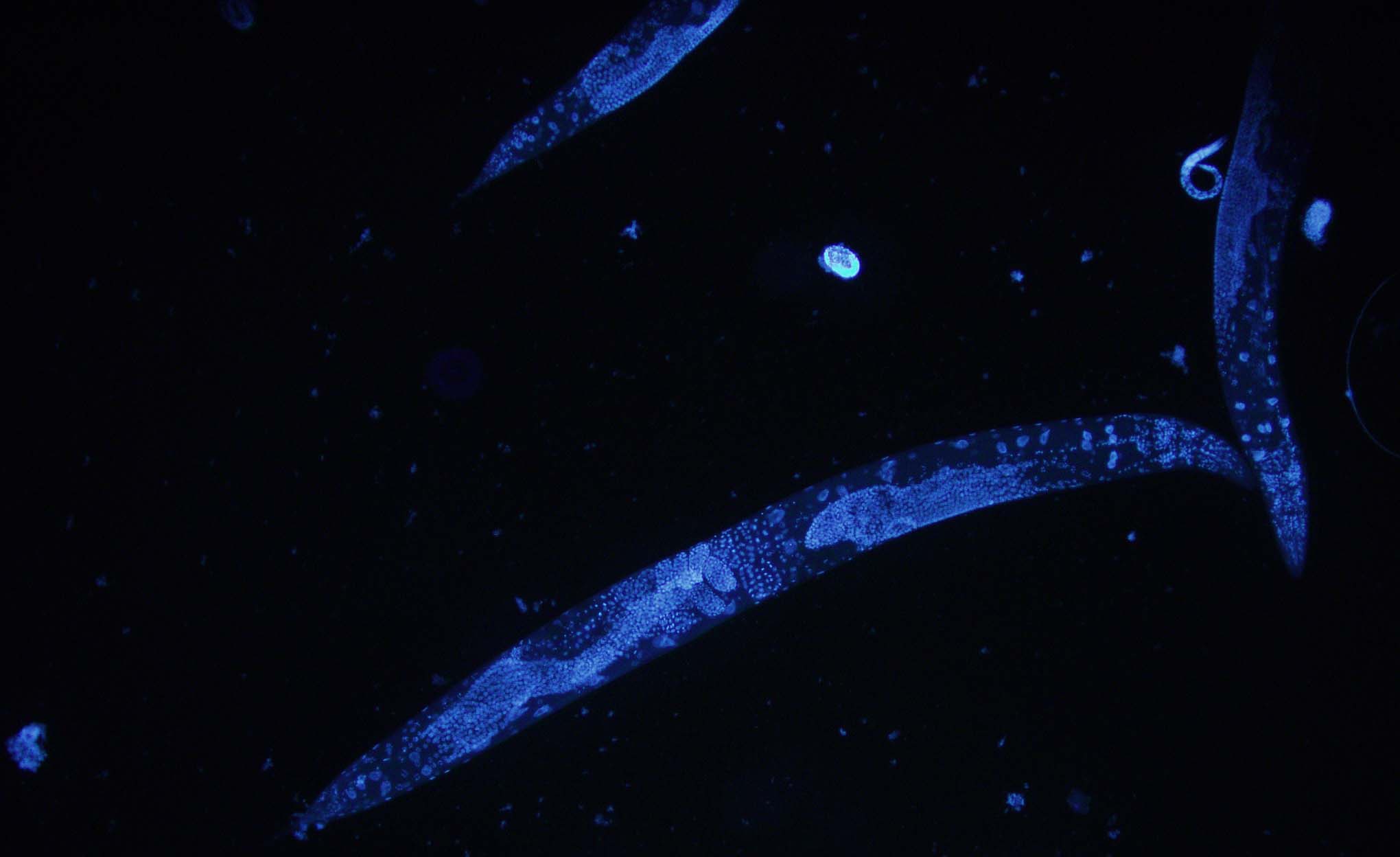 Caenorhabditis elegans (HoPo/Wikimedia)