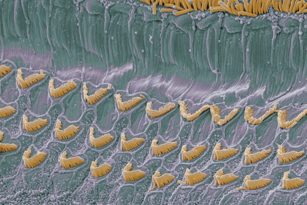 Colored scanning electron micrograph (SEM) view of the top surface of the organ of Corti in the cochlea of the inner ear. There is a row of inner hair cells (yellow) across top and three rows of outer hair cells (crescent shaped). (Getty Images)