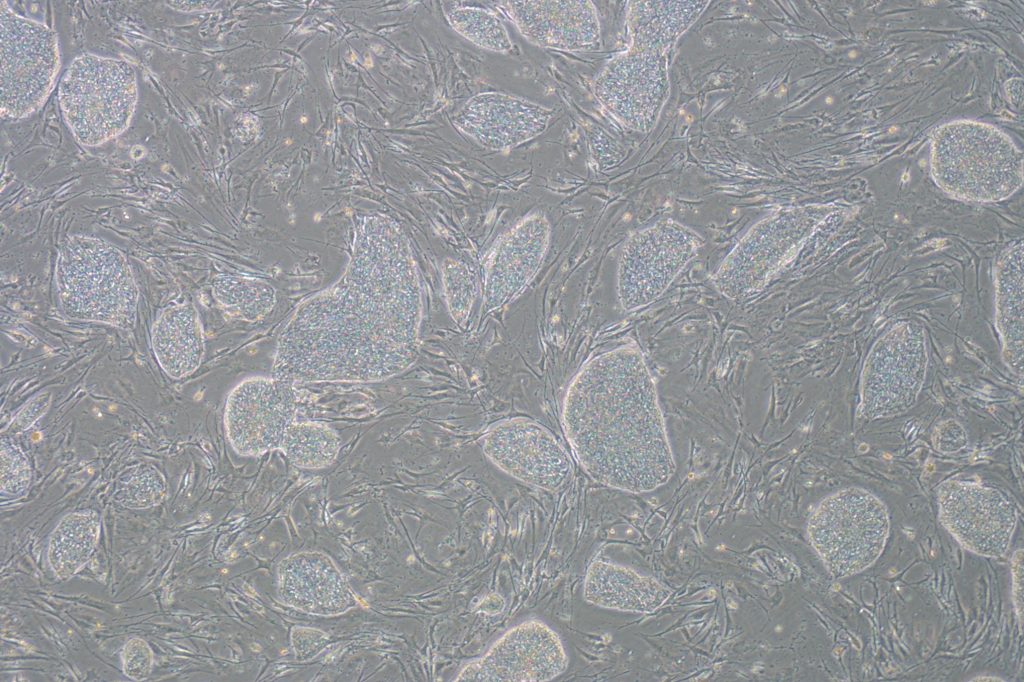 Prader Willi stem cells. (Yaling Liu/UConn Photo)
