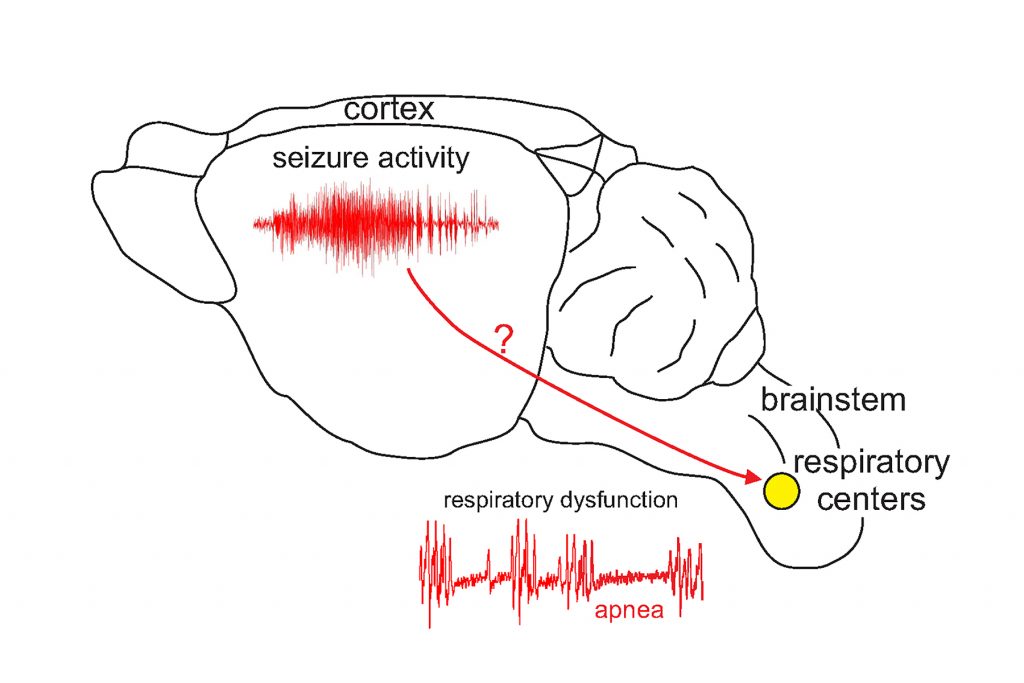 A mouse brain, showing how mutations in Scn1a may cause cortical seizure activity and directly interfere with brainstem respiratory activity and so contribute to death. (Figure by Dan Mulkey & Virge Kask)