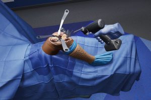 virtual reality knee surgery