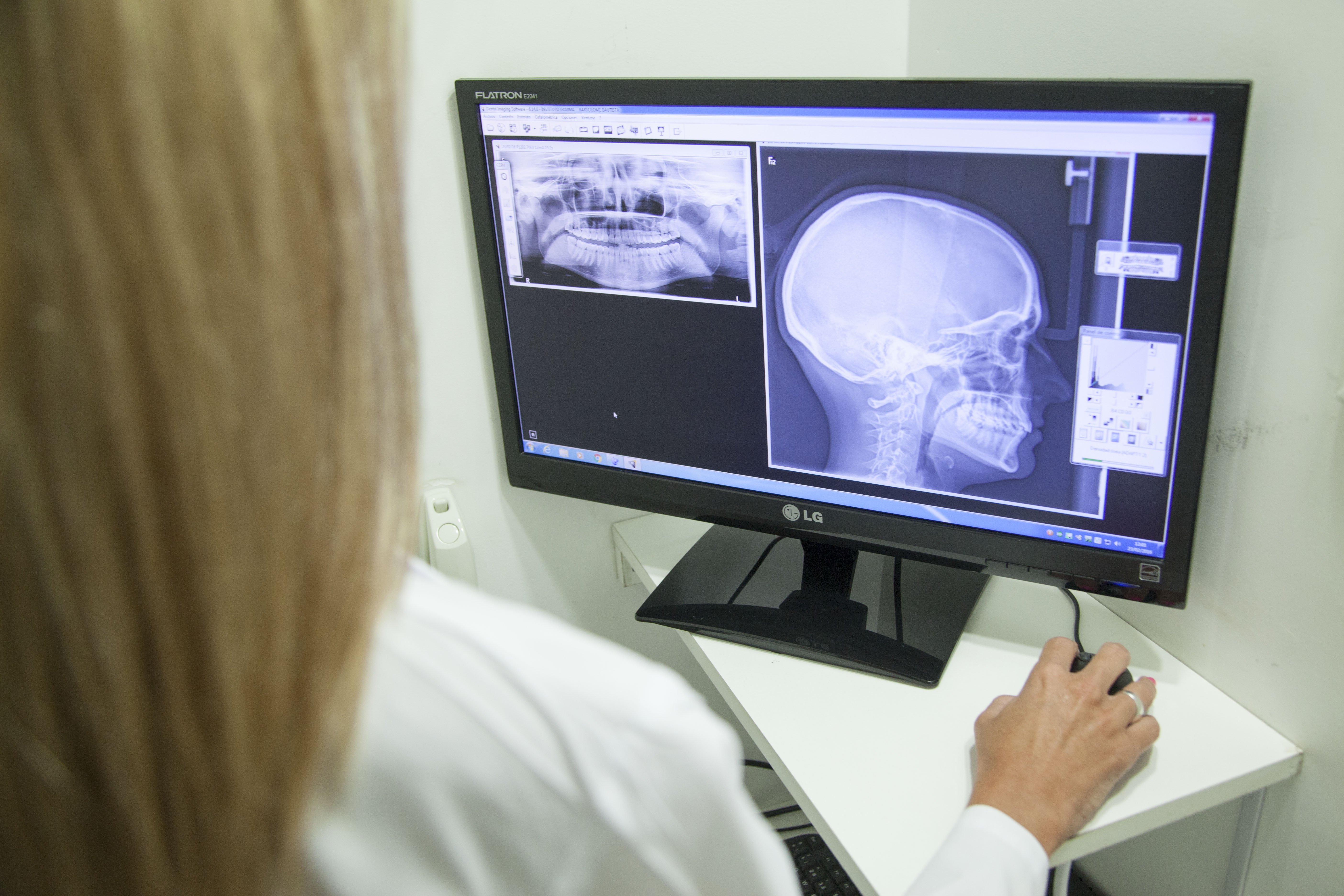 Female doctor looking at xray of jaw