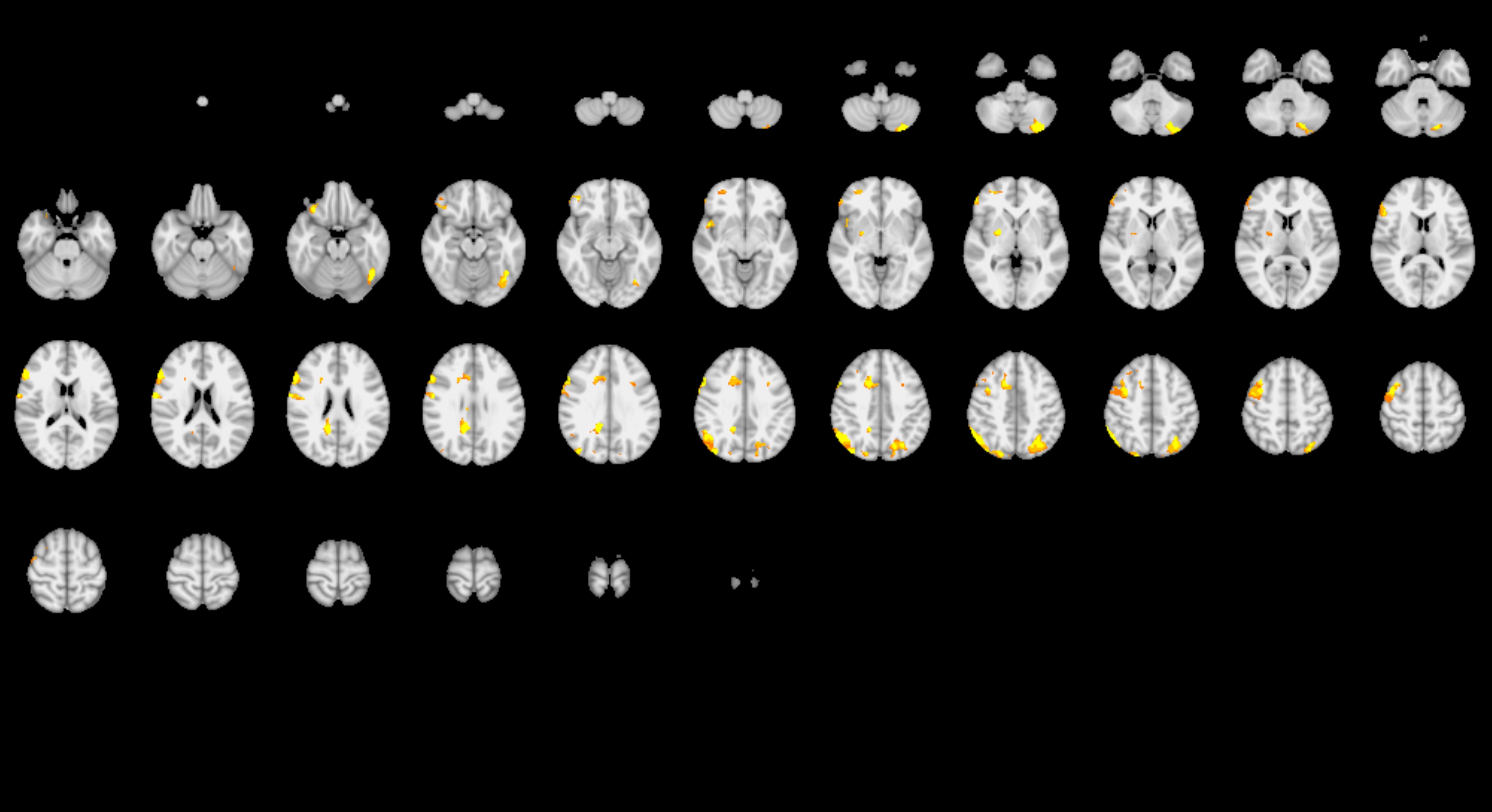 Two sets of imagery from brain analyses