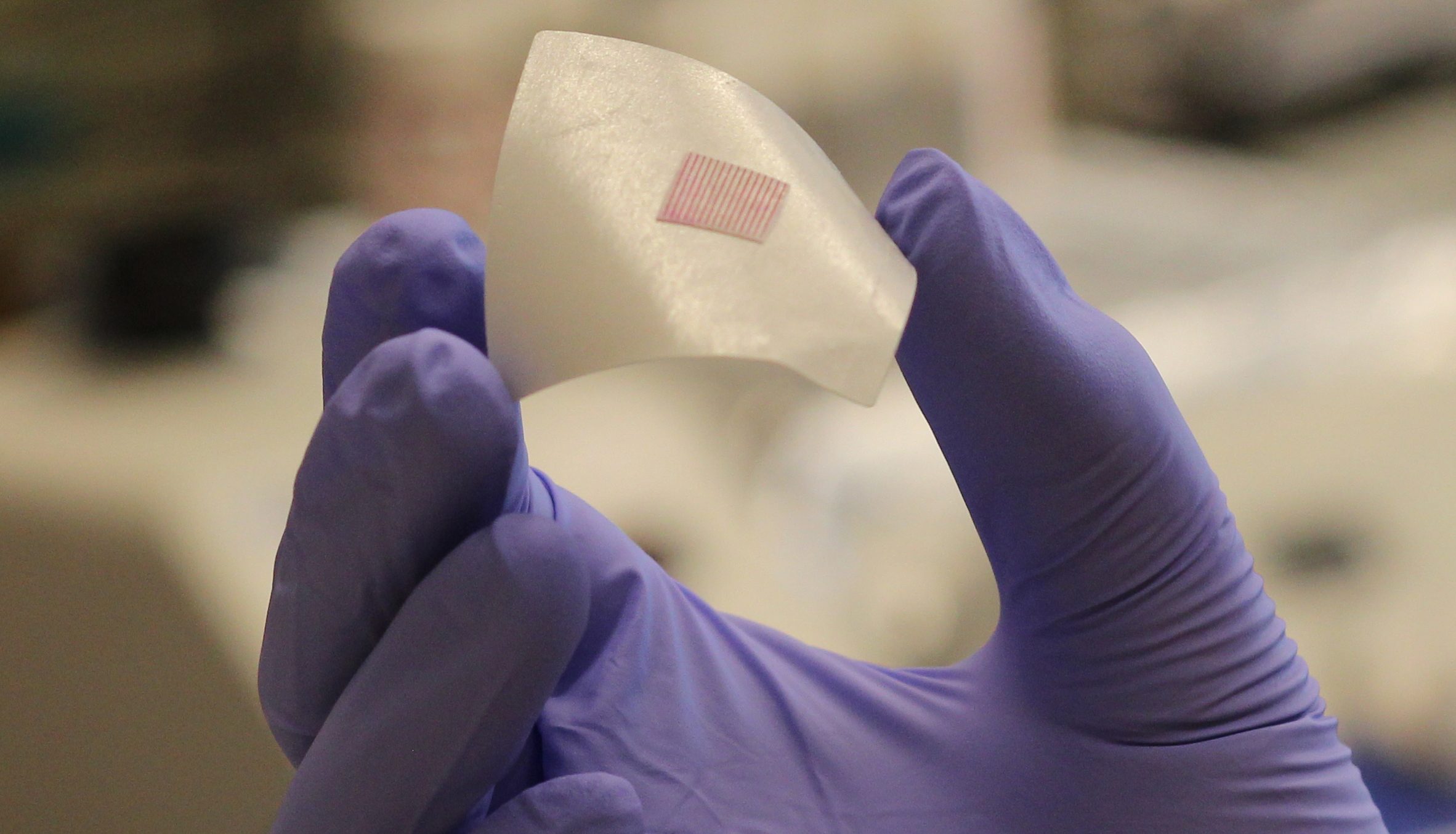 A purple-gloved hand holds the small microneedle patch that was developed at UConn
