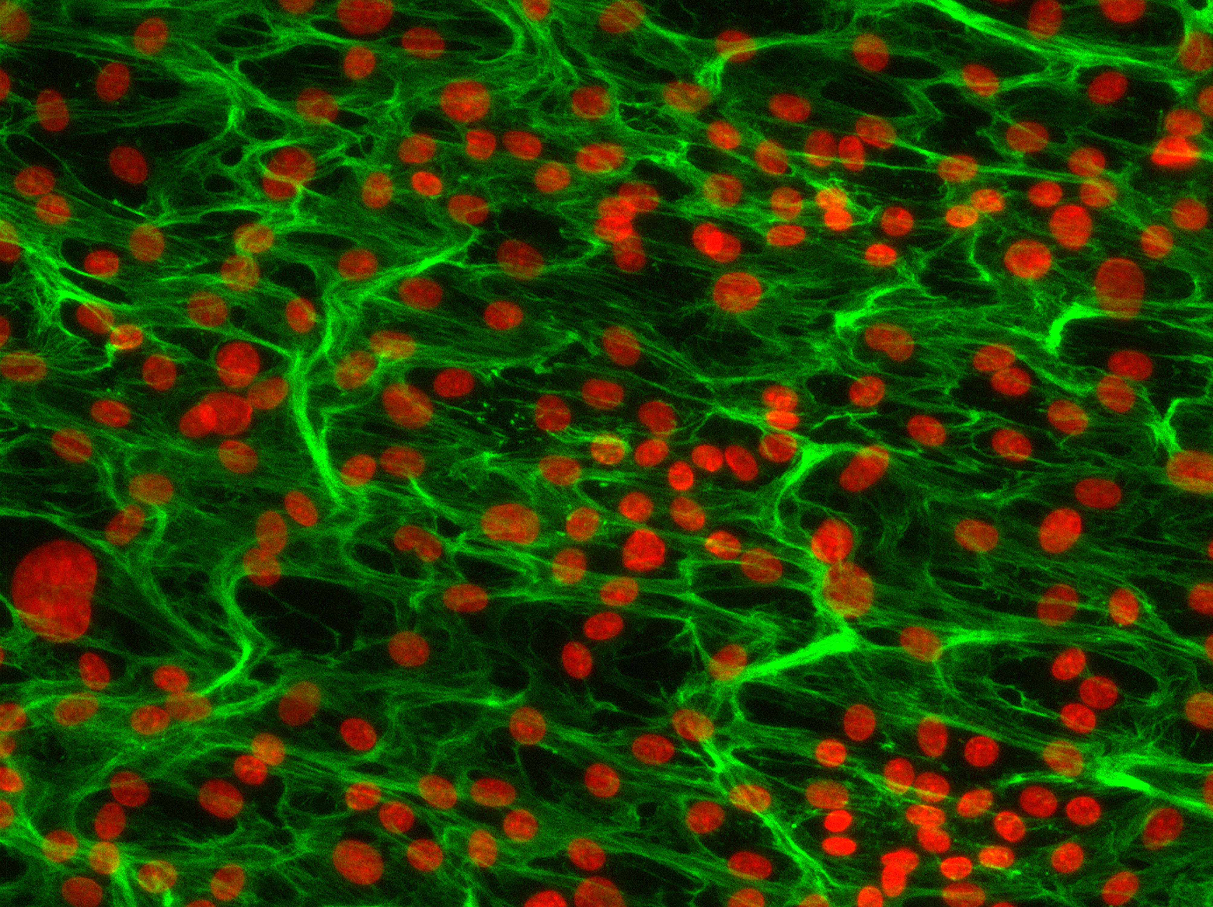 endothelial cells and the extracellular matrix beneath them, from an in in vitro experiment