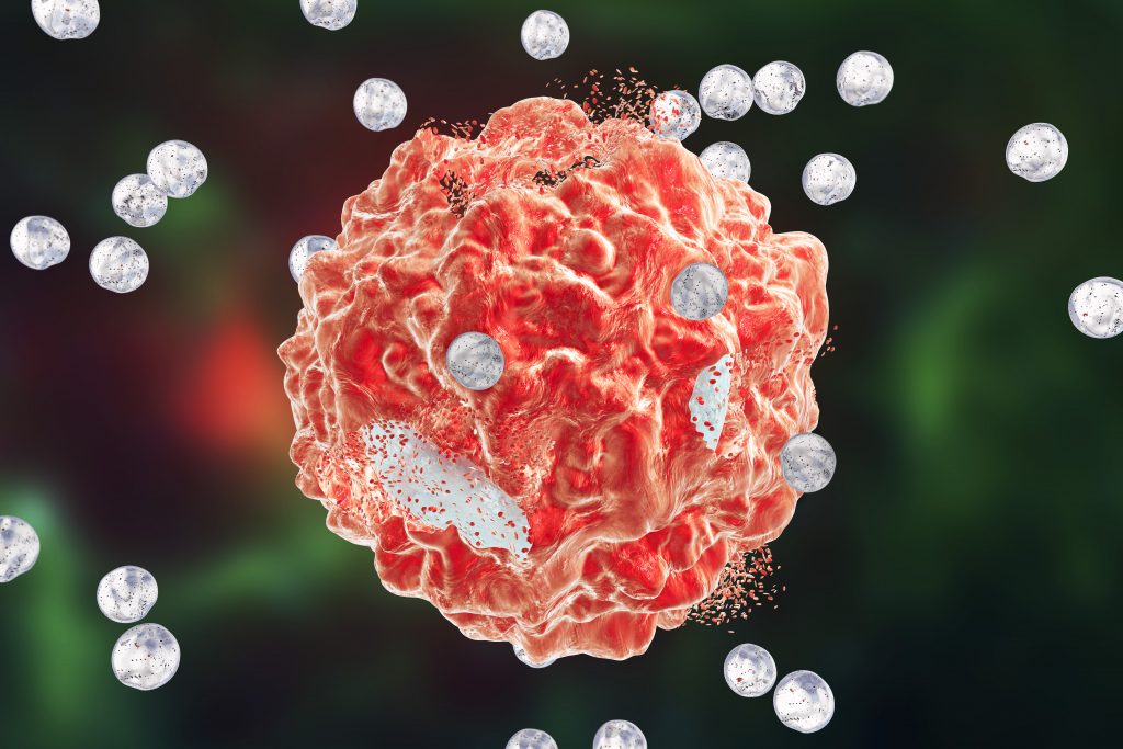 Destruction of a cancer cell by nanoparticles, computer illustration. Conceptual image which illustrates the potential of nanoparticles in the treatment of cancer.