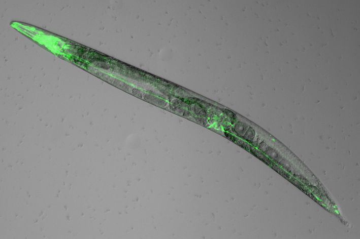 A slide showing a worm asleep, with bright green illuminated portions of its body indicating where melatonin is being produced.
