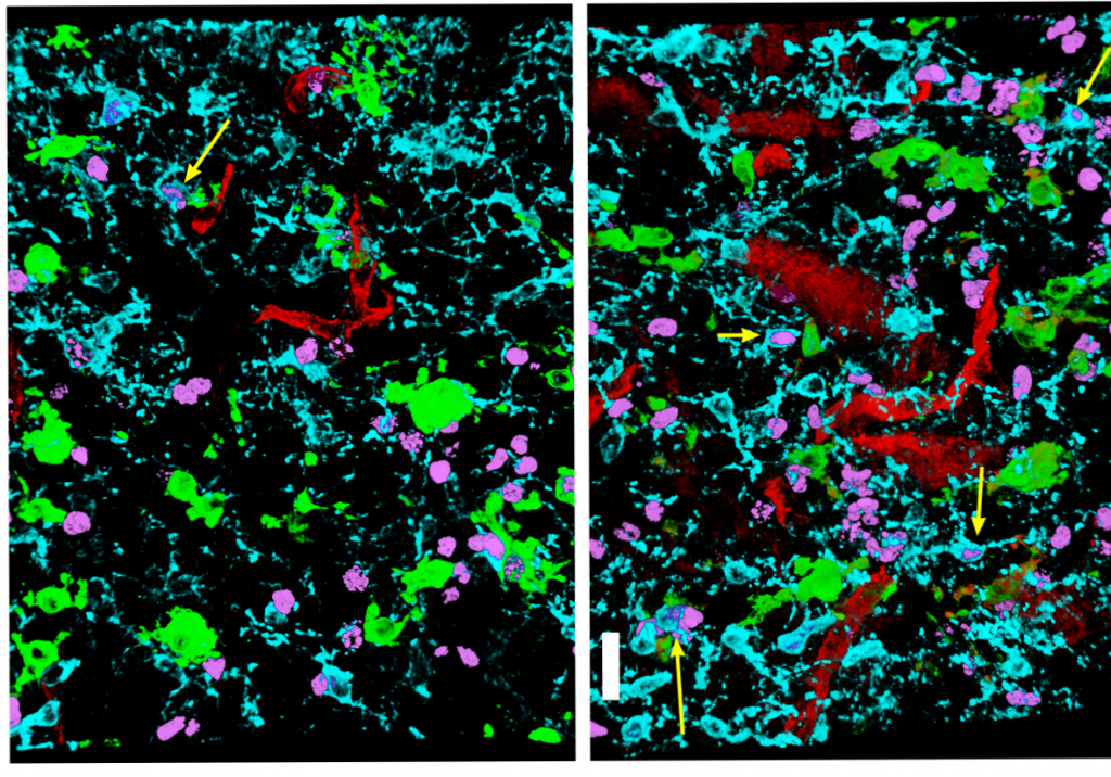 The arrows show where oligodendrocyte precursor cells (blue – all OPCs, pink- dividing OPCs) and their growth factor receptors are in contact with microglia (green) and their signaling proteins (red).