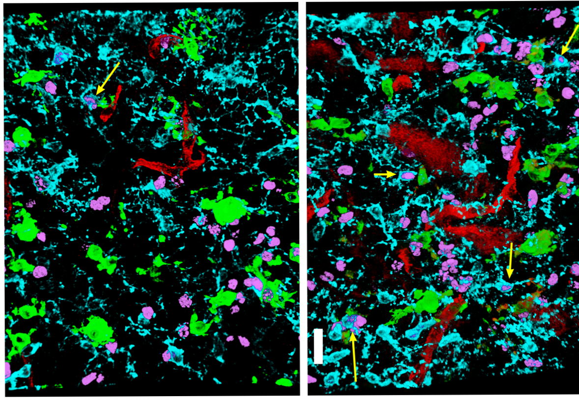 Repairing Nerves Requires Prods of Protein - UConn Today