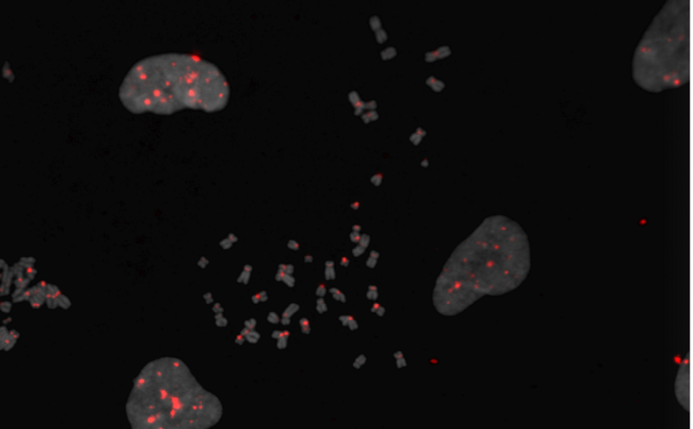 The glowing red dots are centromeres in human chromosomes in the midst of mitosis, multiplying themselves in preparation for the cell dividing in two. The middle of the image shows chromosomes in the classic ‘X’ conformation, with the centromeres at the center of the Xs. The red dots on the grey blobs are also centromeres, but are in cells at a different stage of mitosis.