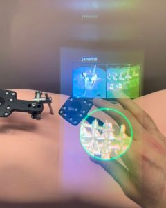 image of augmented reality spine surgery