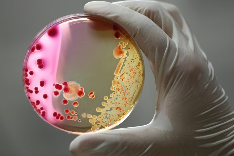 Bacteria macro photographed media in petri dishes in the laboratory.